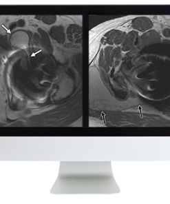 ARRS Controversies in Hip and Pelvis Imaging 2016 (CME VIDEOS)