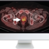 Molecular Imaging and Therapy of Prostate Cancer 2020 (CME VIDEOS)