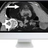 Cross-Sectional Renal Imaging: Techniques and Diagnosis 2020 (CME VIDEOS)