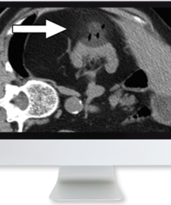 Cross-Sectional Renal Imaging: Techniques and Diagnosis 2020 (CME VIDEOS)