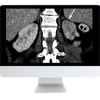 Abdominal and Thoracic Imaging Guidelines Applied: Evidence Versus Opinion 2021 (CME VIDEOS)