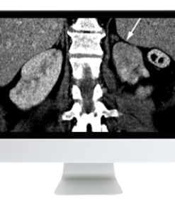 Abdominal and Thoracic Imaging Guidelines Applied: Evidence Versus Opinion 2021 (CME VIDEOS)