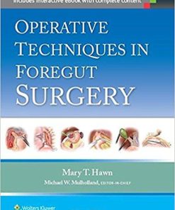 Operative Techniques in Foregut Surgery First