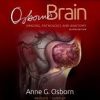 Osborn’s Brain, 2nd Edition