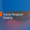 Ovarian Neoplasm Imaging