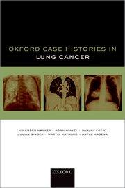 Oxford Case Histories in Lung Cancer 2018