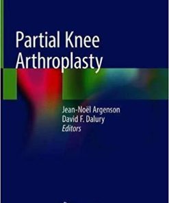 Partial Knee Arthroplasty