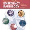 Pearls and Pitfalls in Emergency Radiology: Variants and Other Difficult Diagnoses