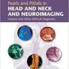 Pearls and Pitfalls in Head and Neck and Neuroimaging: Variants and Other Difficult Diagnoses