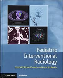 Pediatric Interventional Radiology 1st Edition