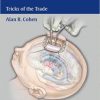 Pediatric Neurosurgery: Tricks of the Trade