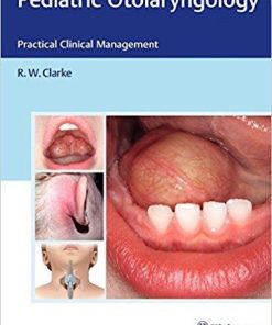 Pediatric Otolaryngology: Practical Clinical Management 1st Edition