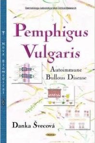 Pemphigus Vulgaris: Autoimmune Bullous Disease