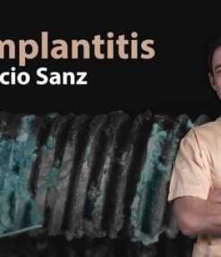 Peri-Implantitis: Prevention and Treatment (Video Course)