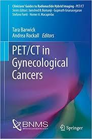 PET/CT in Gynecological Cancers (Clinicians’ Guides to Radionuclide Hybrid Imaging) 1st