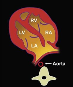 MRIOnline Imaging Mastery Series: Fetal Heart and Great Vessel Evaluation 2021 (CME VIDEOS)