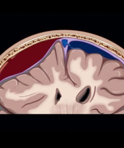 MRIOnline Emergency Series: Emergency Neuroimaging: Brain 2021 (CME VIDEOS)