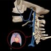 MRIOnline Emergency Series: Emergency Neuroimaging: Head, Neck & Spine 2021 (CME VIDEOS)