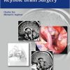 Principles and Practice of Keyhole Brain Surgery