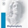 Procedures in Cosmetic Dermatology Series: Blepharoplasty