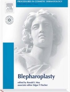 Procedures in Cosmetic Dermatology Series: Blepharoplasty