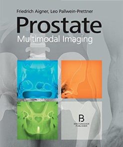 Prostate – Multimodal Imaging