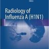 Radiology of Influenza A (H1N1)