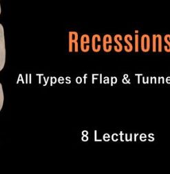 Recessions: All Types of Flap & Tunnel Techniques