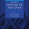 Schiff’s Diseases of the Liver 12th