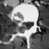 MRI Mastery Series: Degenerative Joint Disease (DJD) 2020 (CME VIDEOS)