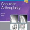 Shoulder Arthroplasty, 2e (PDF)