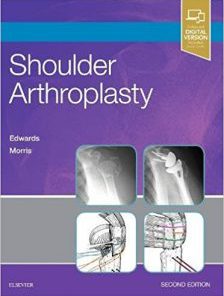 Shoulder Arthroplasty, 2e (PDF)