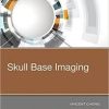 Skull Base Imaging