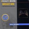 Specialty Imaging Breast MRI: A Comprehensive Imaging Guide