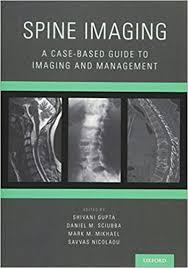 Spine Imaging : A Case-Based Guide to Imaging and Management