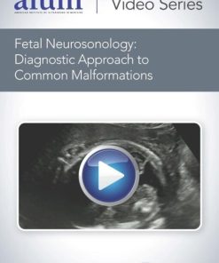 AIUM Fetal Neurosonology: Diagnostic Approach to Common Malformations (CME VIDEOS)