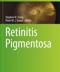 Retinitis Pigmentosa PDF