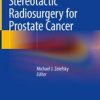 Stereotactic Radiosurgery for Prostate Cancer 1st ed. 2019 Edition