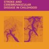 Stroke and Cerebrovascular Disease in Childhood