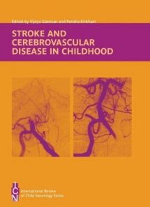 Stroke and Cerebrovascular Disease in Childhood