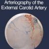 Super-Selective Arteriography of the External Carotid Artery