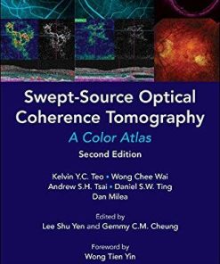 Swept-Source Optical Coherence Tomography: A Color Atlas Second Edition