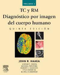 TC y RM. Diagnóstico por imagen del cuerpo humano (Spanish Edition)