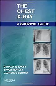 The Chest X-Ray: A Survival Guide, 1e