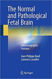 The Normal and Pathological Fetal Brain: Ultrasonographic Features