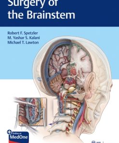 Surgery of the Brainstem (PDF)