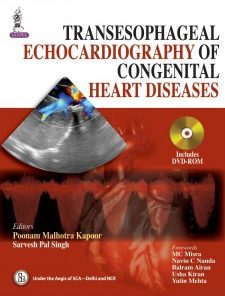 Transesophageal Echocardiography of Congenital Heart Diseases