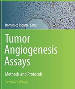 Tumor Angiogenesis Assays: Methods and Protocols (Methods in Molecular Biology, 2572) 2nd ed. 2023 Edition PDF