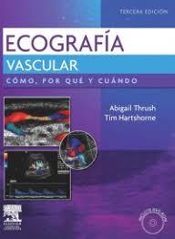 Ultrasonido vascular. Cómo, por qué y cuándo: Cómo, por qué y cuándo (Spanish Edition)