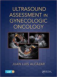 Ultrasound Assessment in Gynecologic Oncology (PDF)